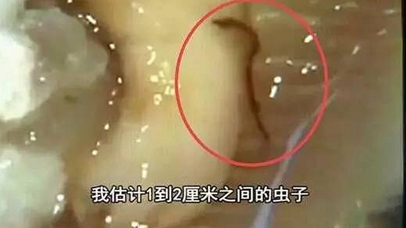 一只生蠔引起的冤案，觸動(dòng)了餐飲人的“麻木神經(jīng)”